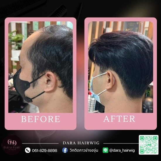 วิกผมผู้ชายเหมือนจริง