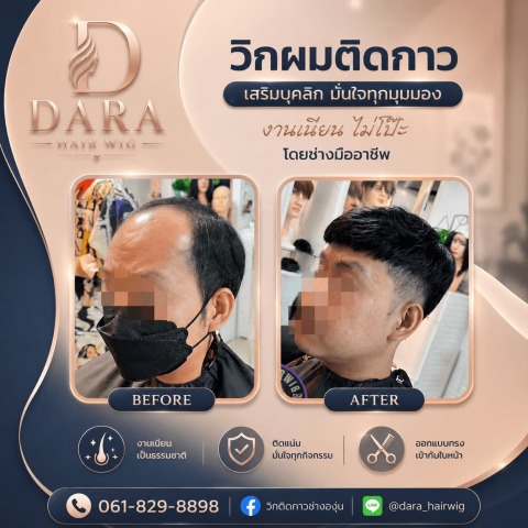 วิกผมสำหรับคนหัวล้าน