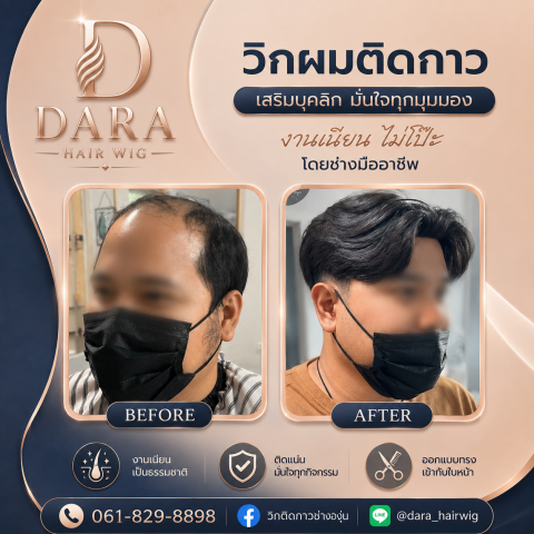 วิกผมผู้ชายติดกาว
