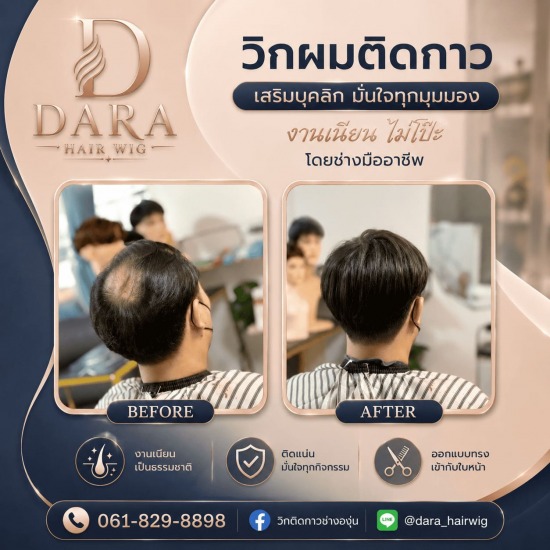  วิกติดกาวผู้ชาย
