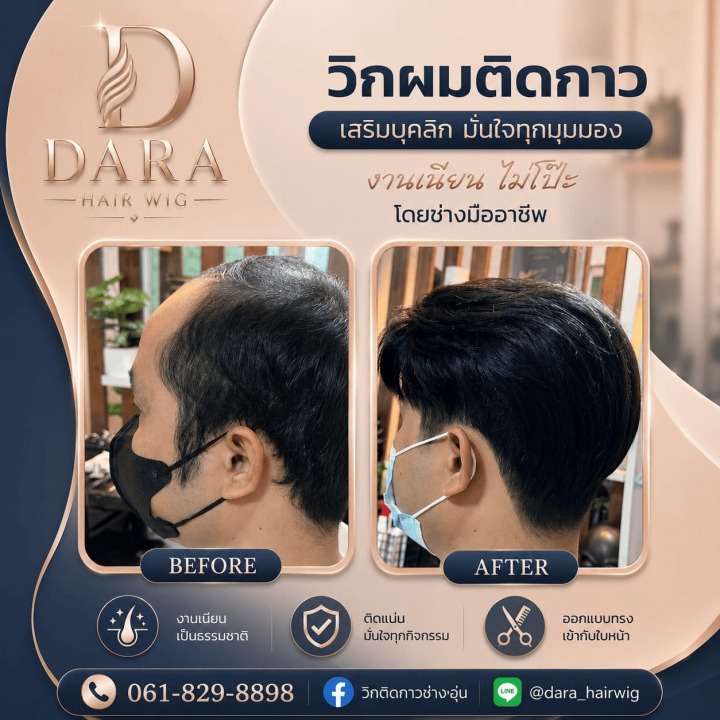 วิกผมผู้ชาย